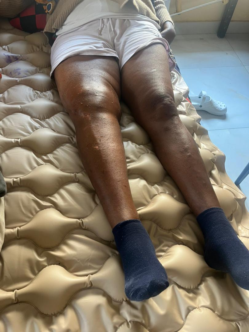 Anonymous — Knee Rehabilitation